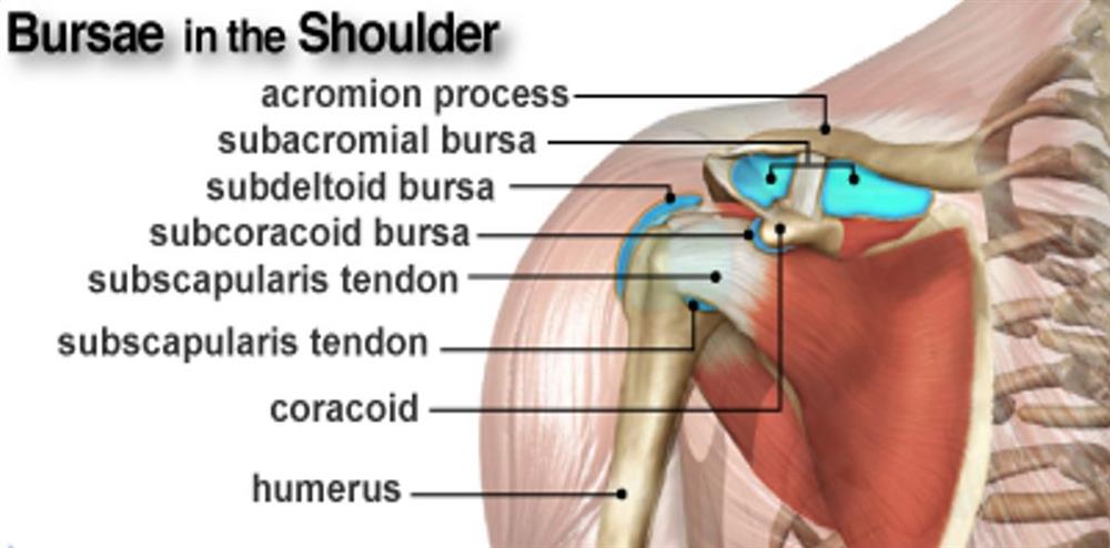 Subdeltoid Bursitis Subdeltoid Bursitis
