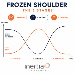 Frozen shoulder stages showing changes in pain levels and range of motion over time